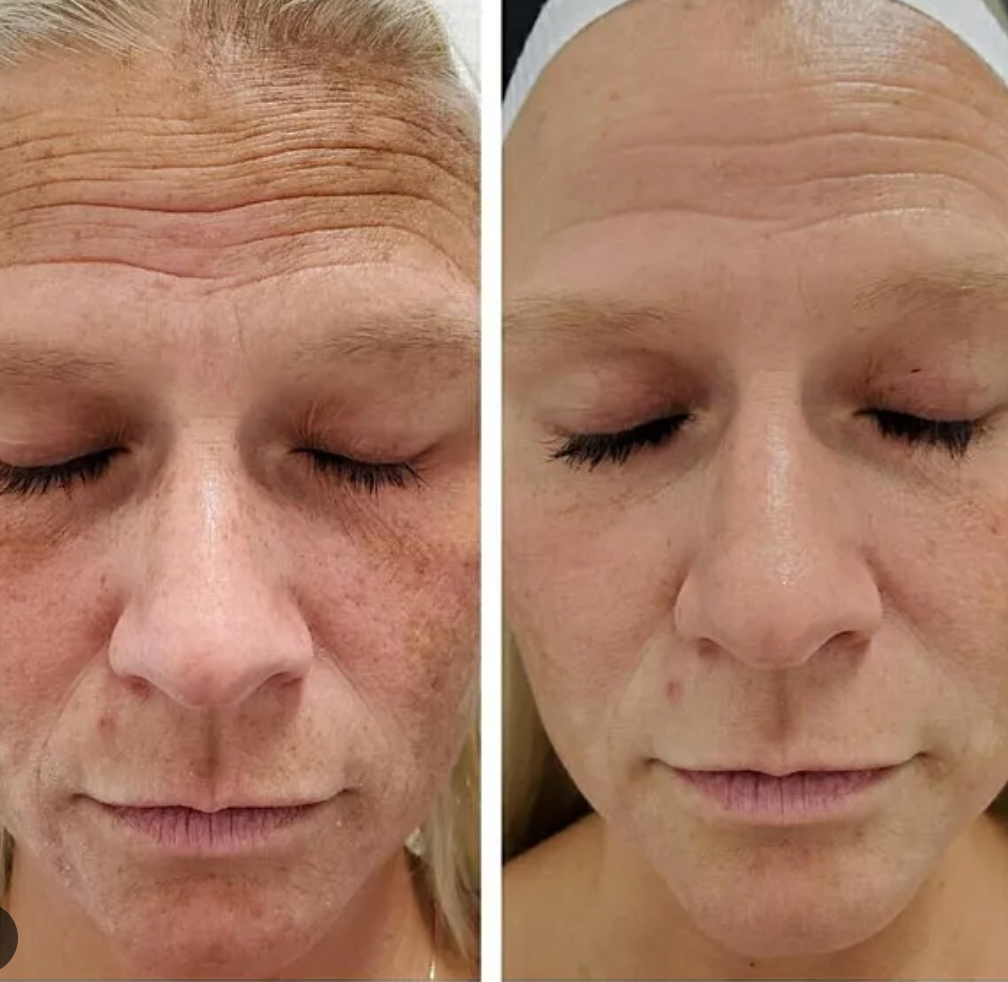 AnteAGE MDX Biosome Brightener