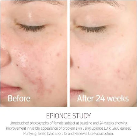 Epionce Lytic Gel Cleanser